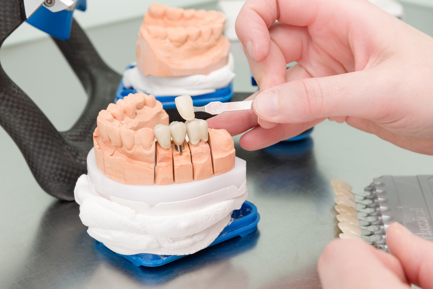 Implantate